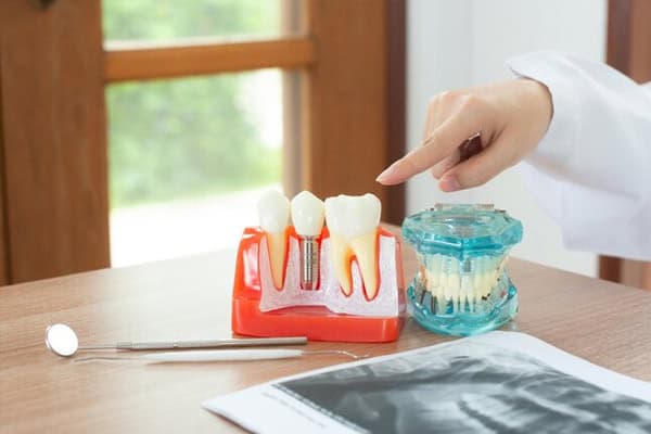 Dental Bridges in Newark,DE