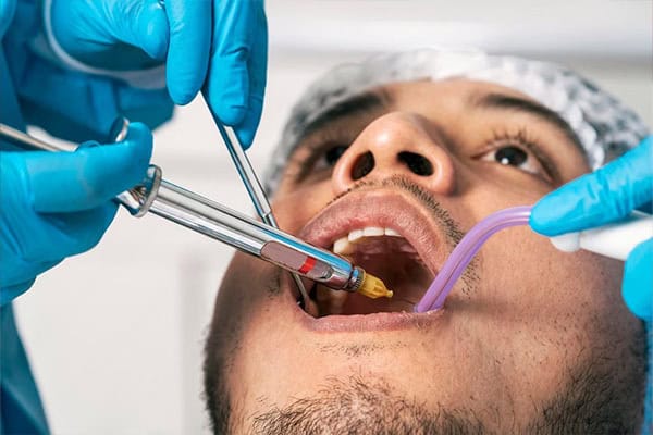Dental Sealants in Newark,DE