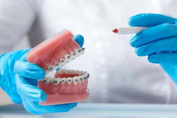 Partial Dentures in Newark,DE