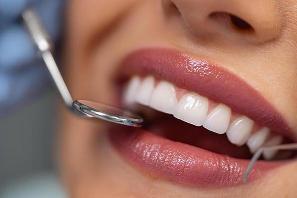 Tooth Extractions in Newark, DE