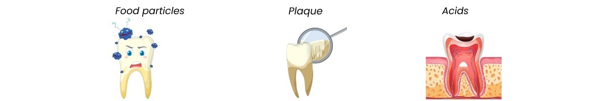How Dental Sealants Work? | Main Street Dental