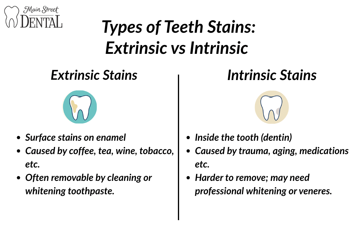 Types of Teeth Stains - Extrinsic vs Intrinsic in Newark | Main Street Dental