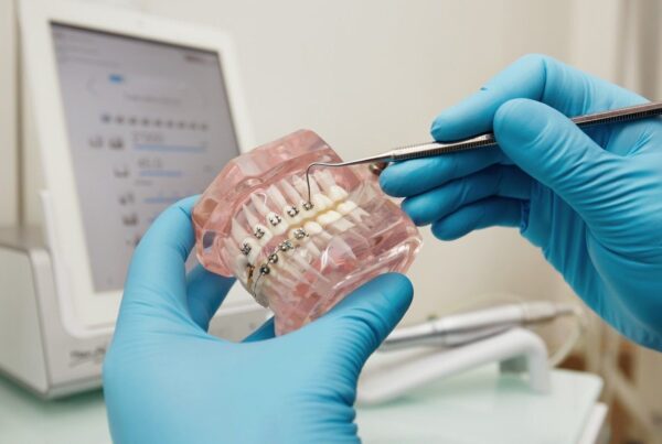 Brace Teeth | Main Street Dental