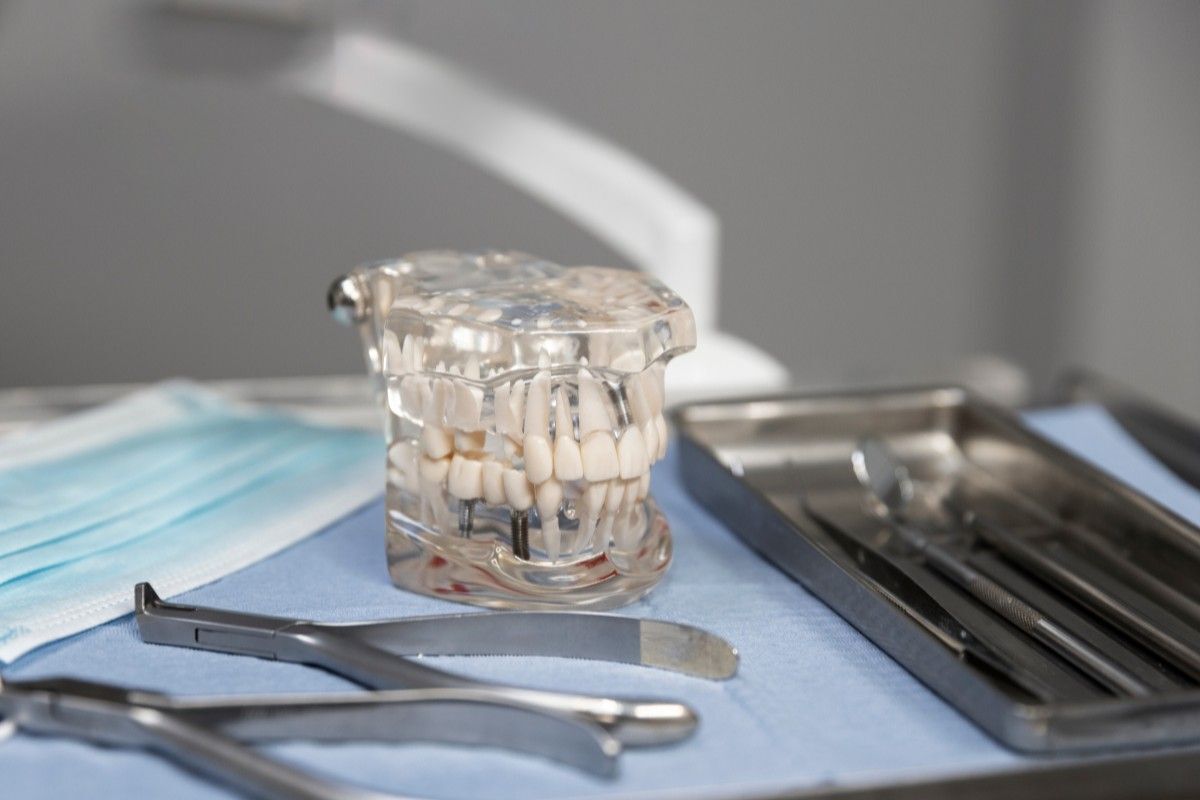 Dental Implant Cost in the USA: 2025–2026 Guide?