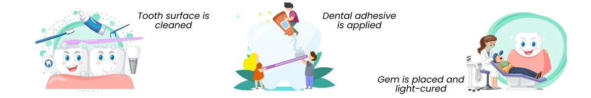 Tooth Gem Trend: What to Know Before Getting One | Main Street Dental