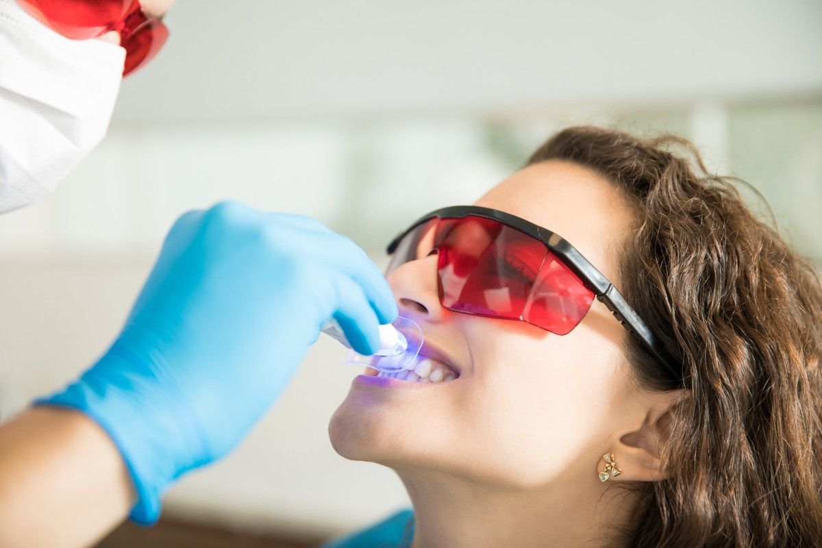 Professional teeth whitening vs DIY kit | Main Street Dental