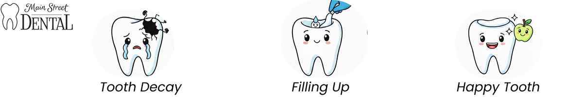 What Are Dental Fillings
